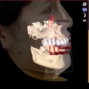 Escáner facial 3D: Revolución Tecnológica en Odontología.